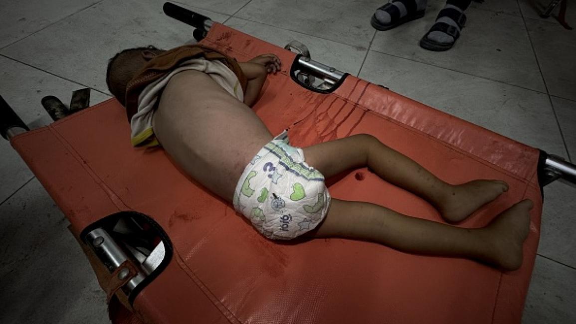UNICEF warns famine threatening lives of over 320,000 children