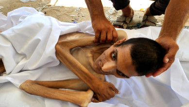 Death toll of starvation in Gaza raises to 175