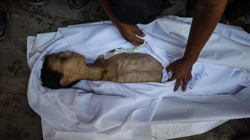 Starvation in Gaza: 188 martyrs, children wasting away as aid blockade tightens