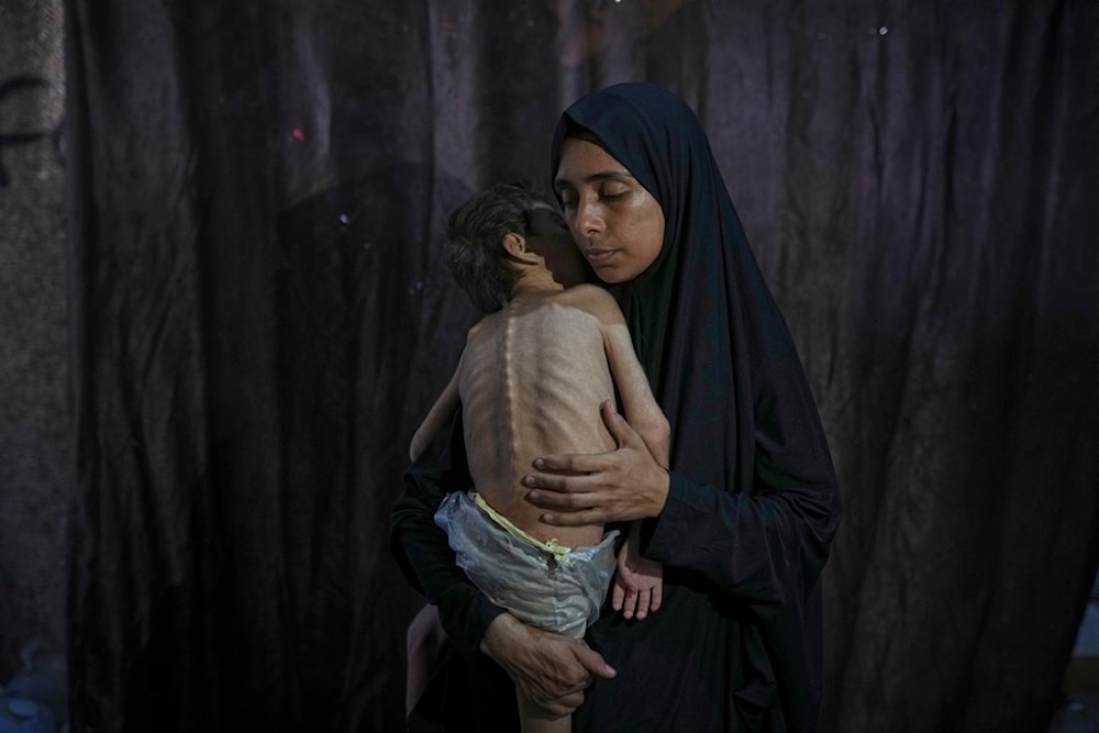 What Israeli-made famine has done to Gaza's children: NYT