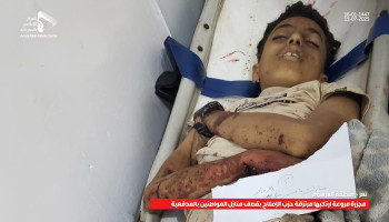 مركز نداء الكرامة يُدين جريمة مليشيا الإصلاح في التعزية