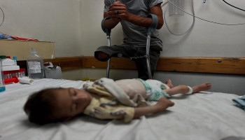 استشهاد 4 أطفال خلال 24 ساعة نتيجة المجاعة بغزة