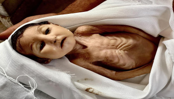 الأغذية العالمي: المساعدات التي تصل غزة لا تكفي لمنع انتشار المجاعة