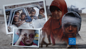 لا حساب لأطفال اليمن وفلسطين في حسابات يومهم العالمي