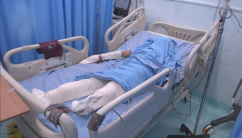 إصابة امرأة بانفجار جسم من مخلفات العدوان في مديرية المصلوب بالجوف