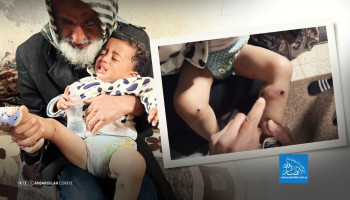 جنود صهاينة يعذبون طفلاً رضيعاً بالحرق ودق المسامير .. القصة الكاملة, وما خفي أسوأ مما بدى على جسم الرضيع "جواد"