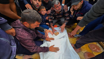 72,551 شهيدًا و172,274 إصابة منذ بدء حرب الإبادة الصهيونية على غزة