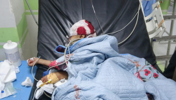 إصابة طفلة برصاص قناص تابع لمرتزقة العدوان في قعطبة بالضالع