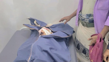 استشهاد امرأة بقذيفة أطلقها مرتزقة العدو السعودي في مديرية الصلو بتعز