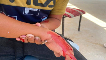 العدو يصيب طالبا فلسطينيًّا برصاصة داخل مدرسته غرب غزة