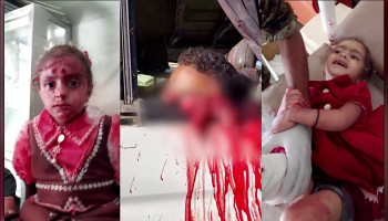 وزارة الصحة: استشهاد وإصابة 11 مواطنًا باستهداف العدو السعودي محافظتي إب وتعز