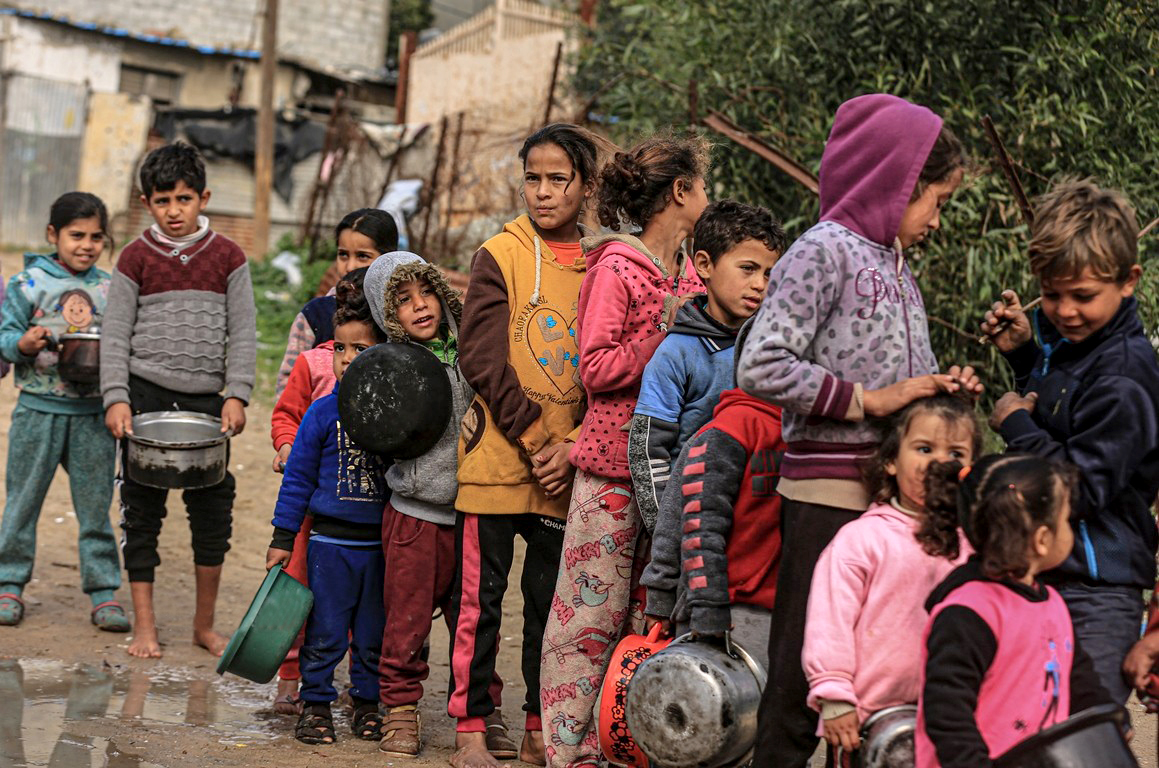 الصحة العالمية: 112 طفلا يدخلون مستشفيات غزة يوميا بسبب سوء التغذية