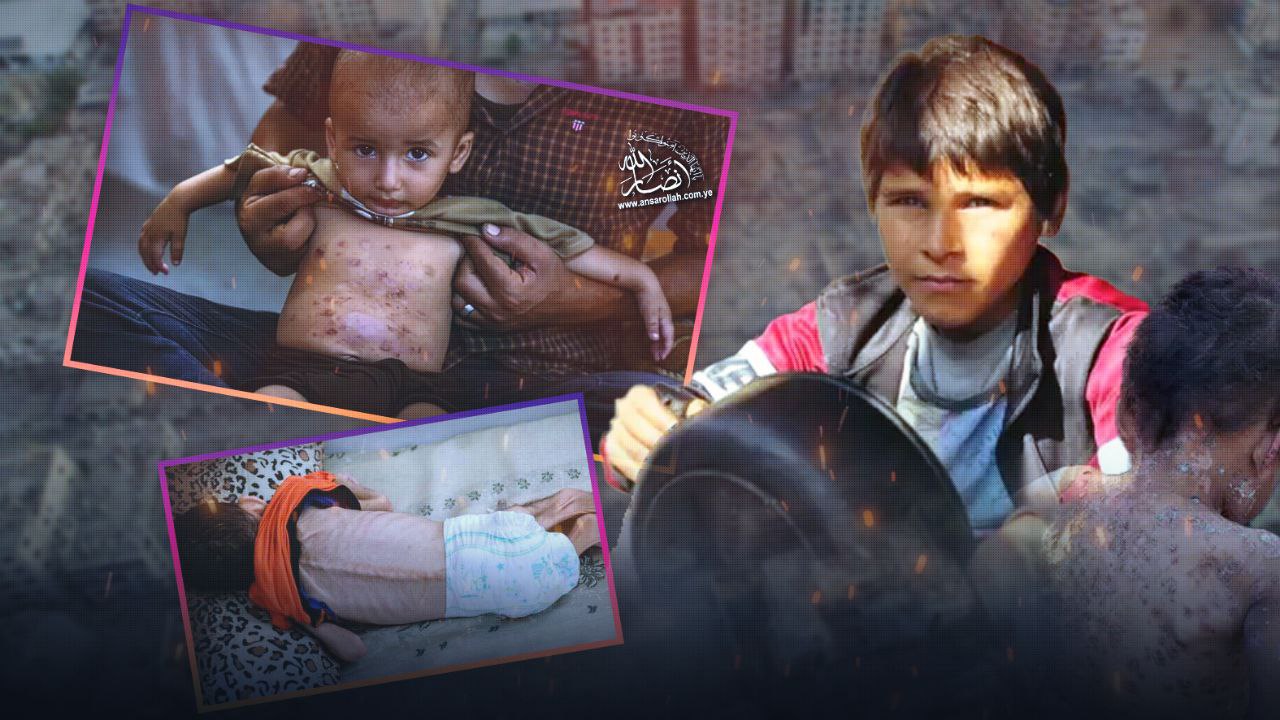 سحايا وحمى شوكية وتوقف غسيل الكلى .. انهيار صحي في غزة