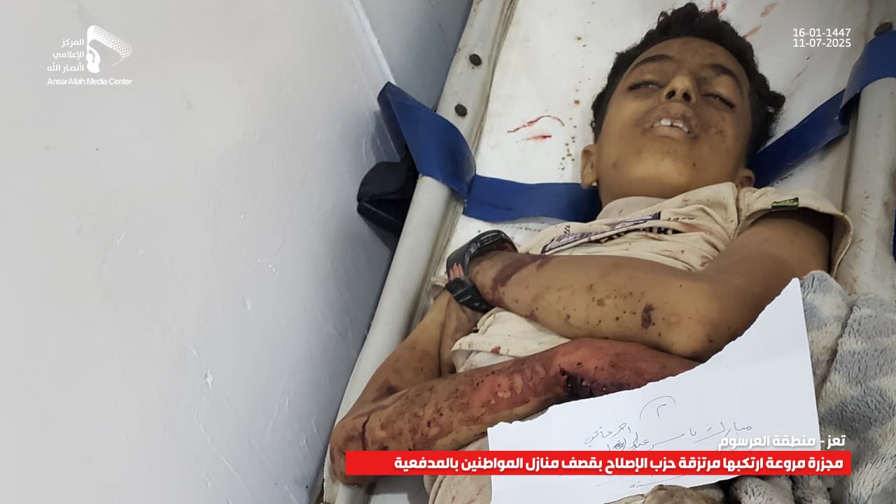مركز نداء الكرامة يُدين جريمة مليشيا الإصلاح في التعزية