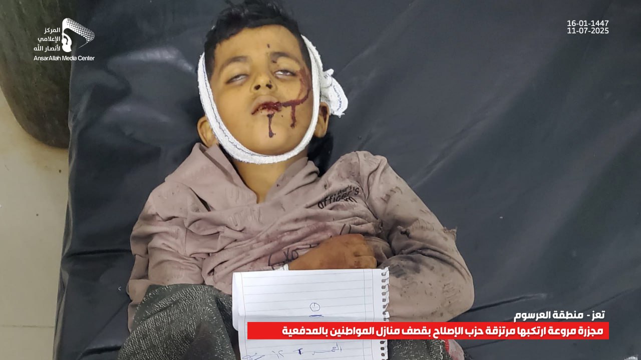 المركز اليمني لحقوق الإنسان يندد بمجزرة الاصلاح بحق الأطفال في تعز