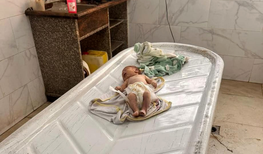 استشهاد 67 طفلا بغزة نتيجة سوء التغذية ونقص الدواء