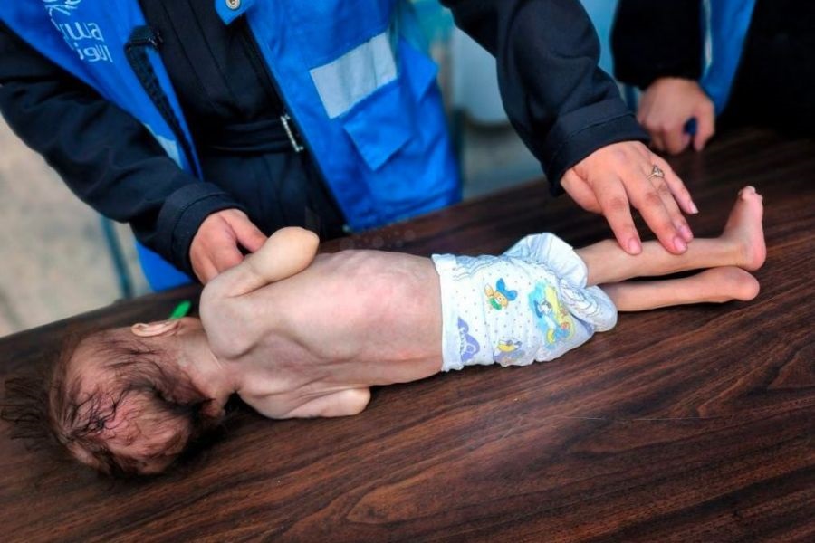 "الأغذية العالمي": شخص من 3 في غزة لا يتناول الطعام أيامًا