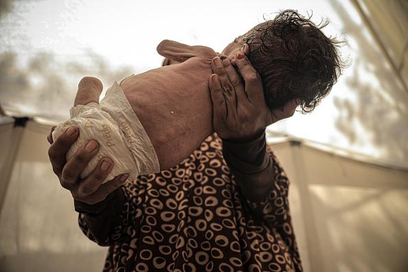 "أونروا": هناك مجاعة حقيقية في غزة