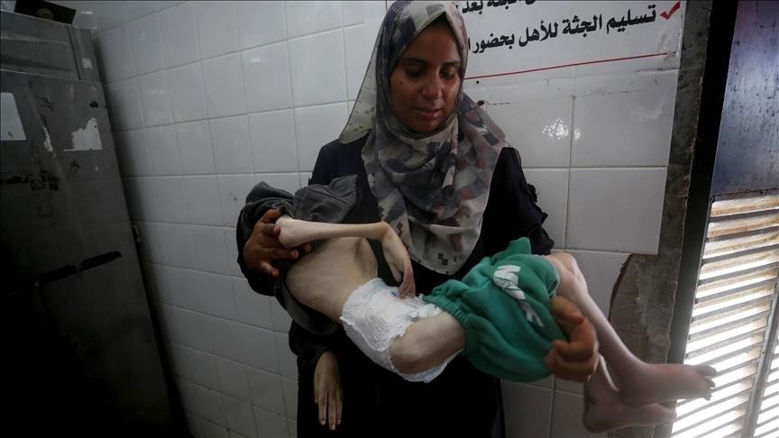 الصحة العالمية: وفاة 99 فلسطينيا في غزة منذ مطلع العام بسبب سوء التغذية