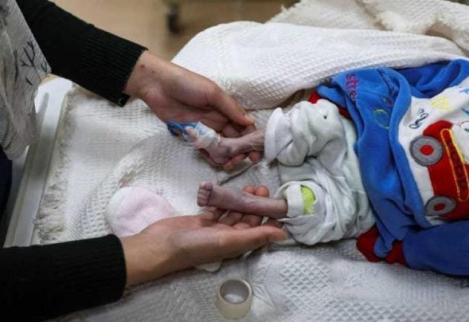 حصيلة ضحايا الإبادة الإسرائيلية بغزة تتجاوز 228,800 شهيد وجريح